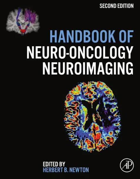 Handbook of Neuro-Oncology Neuroimaging cover