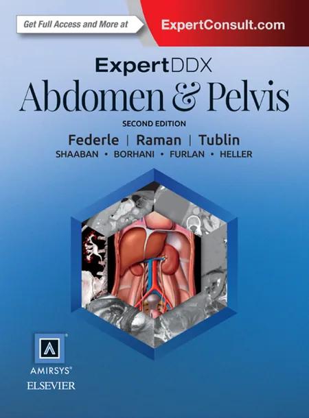 ExpertDDx: Abdomen and Pelvis E-Book cover