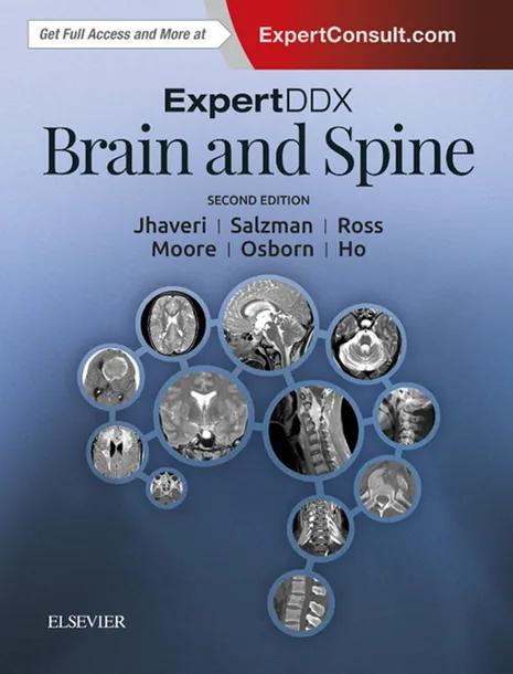 ExpertDDx: Brain and Spine E-Book cover