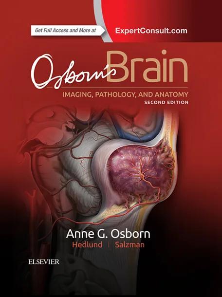 Osborn's Brain cover