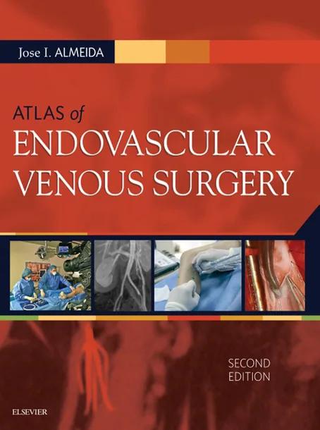 Atlas of Endovascular Venous Surgery cover