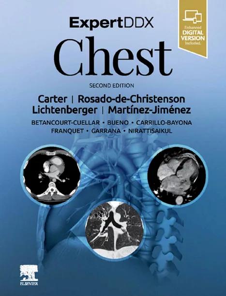 ExpertDDx: Chest cover