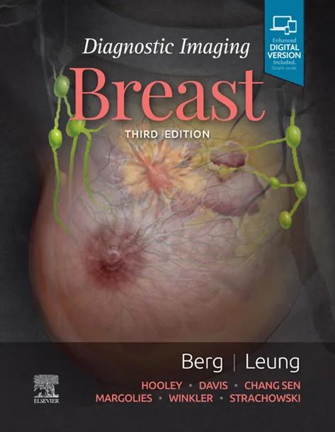 Diagnostic Imaging: Breast cover
