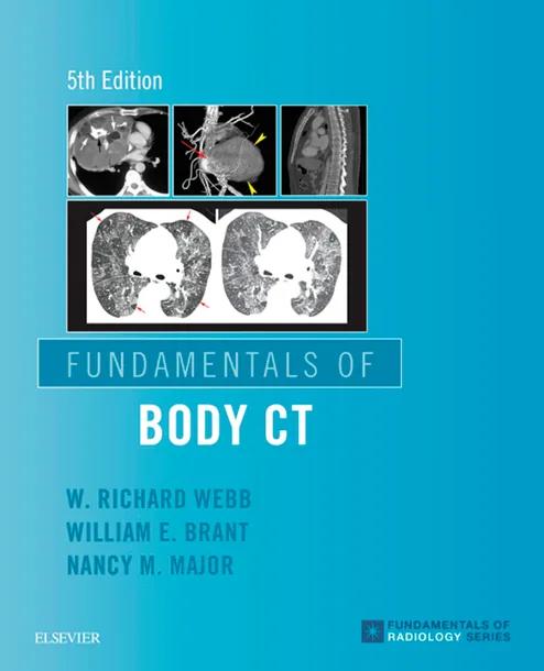 Fundamentals of Body CT cover