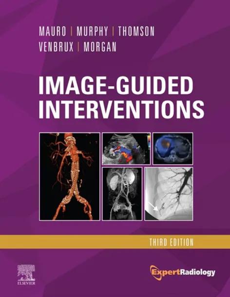Image-Guided Interventions E-Book cover