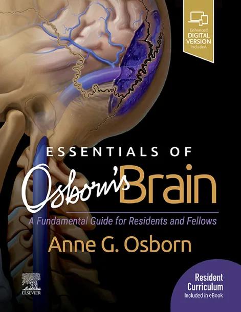 Essentials of Osborn's Brain cover