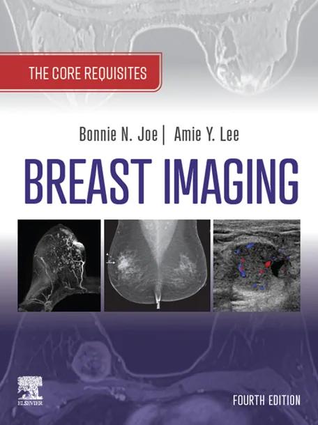 Breast Imaging cover