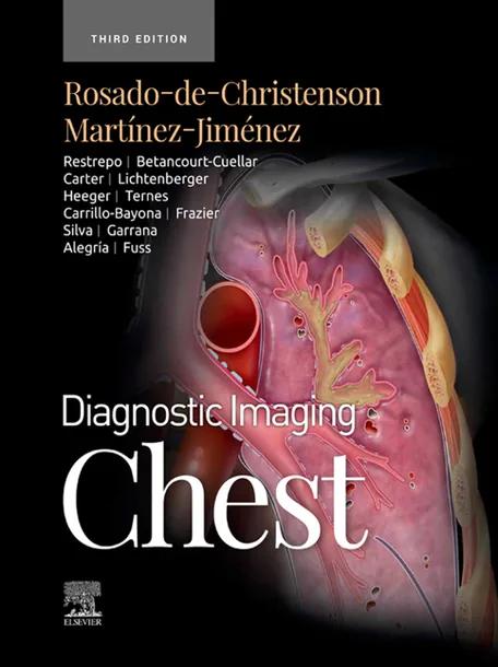 Diagnostic Imaging: Chest cover