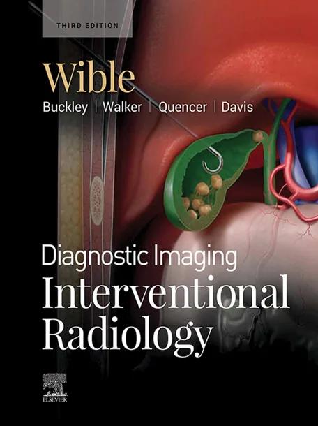 Diagnostic Imaging: Interventional Radiology cover