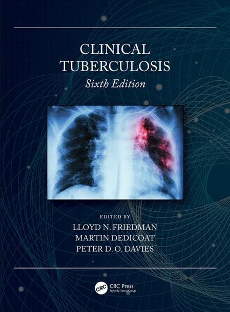 Clinical Tuberculosis cover