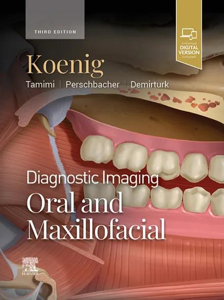 Diagnostic Imaging: Oral and Maxillofacial cover