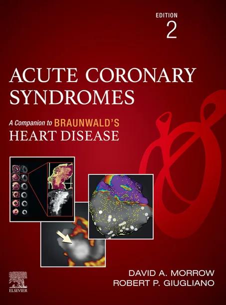 Acute Coronary Syndromes