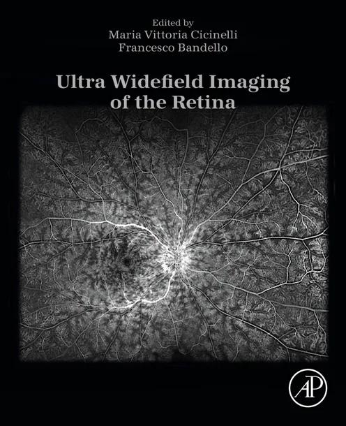 Ultra Widefield Imaging of the Retina cover