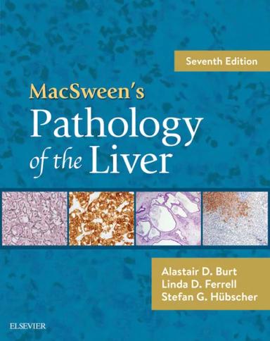 MacSween's Pathology of the Liver