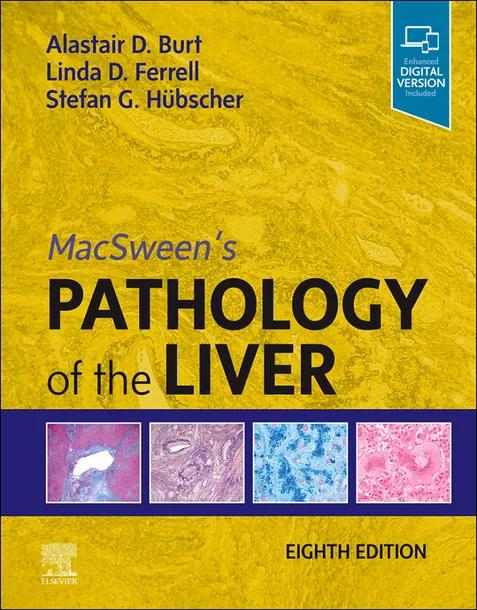 MacSween's Pathology of the Liver cover