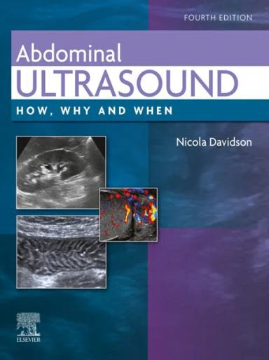 Abdominal Ultrasound
