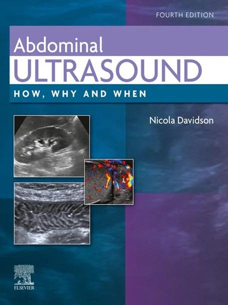 Abdominal Ultrasound