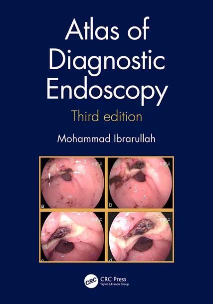 Atlas of Diagnostic Endoscopy, 3E cover