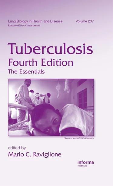 Tuberculosis