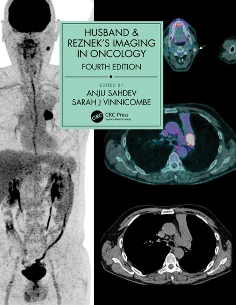 Husband & Reznek's Imaging in Oncology cover