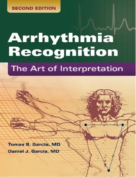 Arrhythmia Recognition