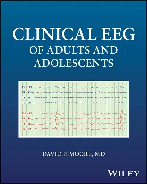 Clinical EEG of Adults and Adolescents cover