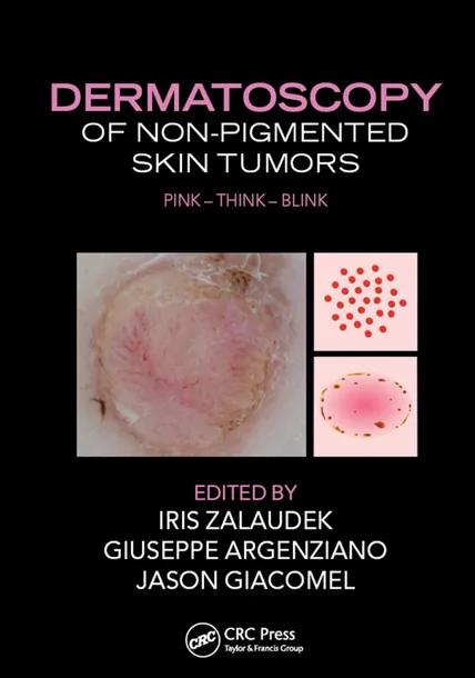 Dermatoscopy of Non-Pigmented Skin Tumors cover