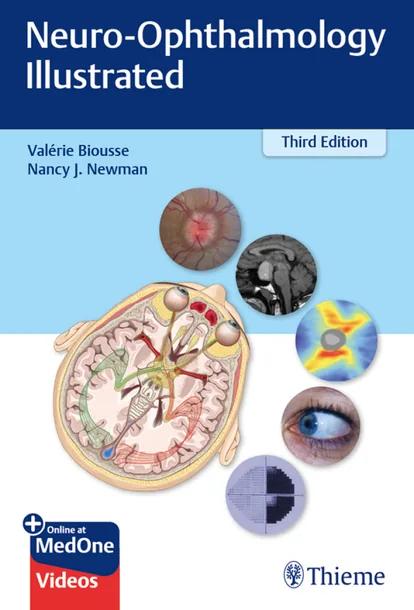 Neuro-Ophthalmology Illustrated cover