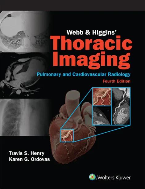 Webb & Higgins Thoracic Imaging: eBook with Multimedia cover