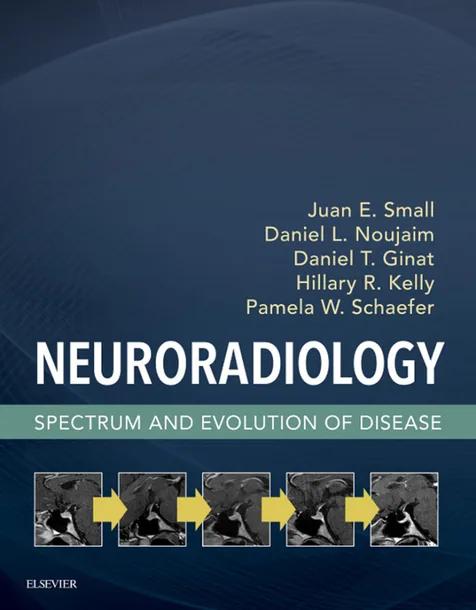 Neuroradiology