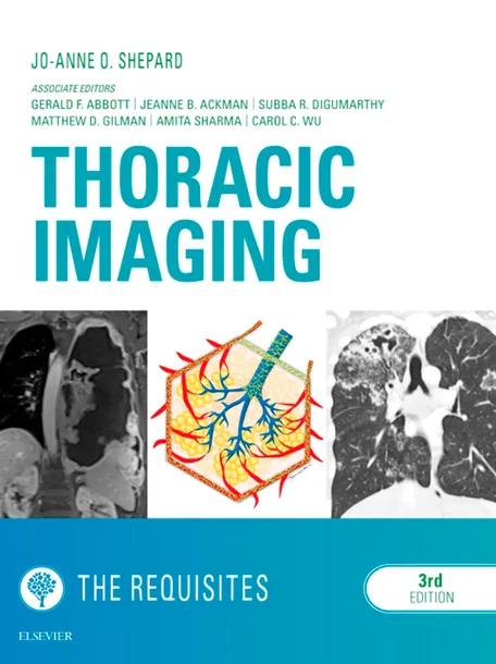 Thoracic Imaging: The Requisites cover