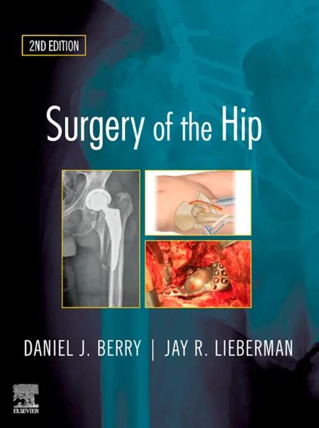 Surgery of the Hip cover
