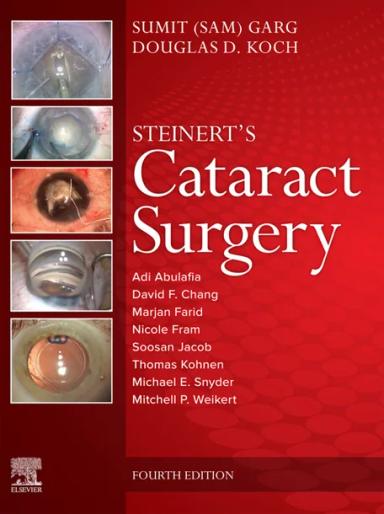 Steinert's Cataract Surgery