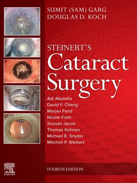 Steinert's Cataract Surgery cover