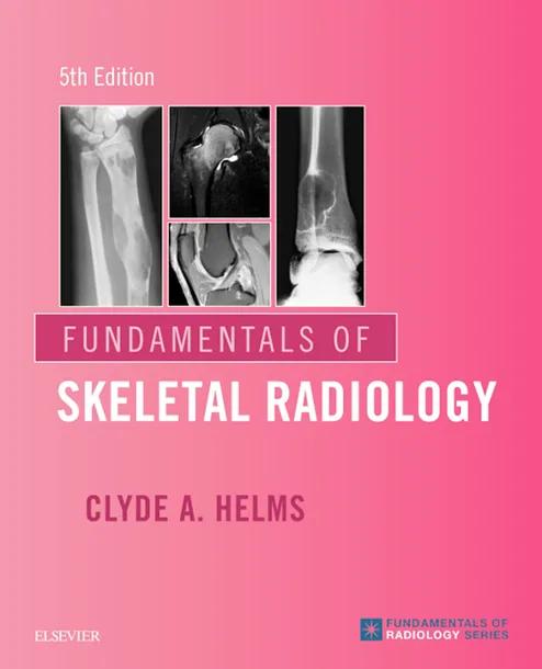Fundamentals of Skeletal Radiology cover