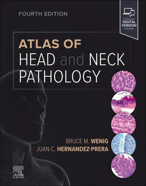 Atlas of Head and Neck Pathology cover