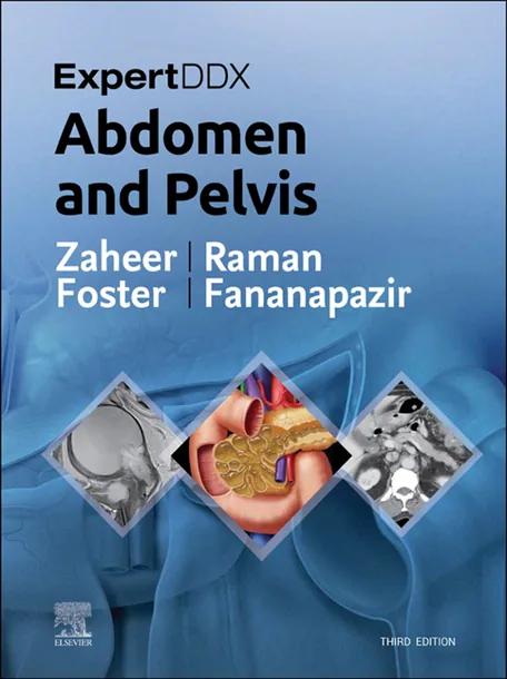 ExpertDDx: Abdomen and Pelvis cover