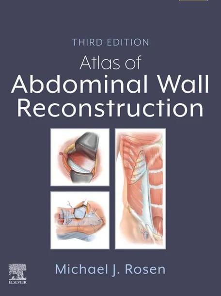Atlas of Abdominal Wall Reconstruction cover