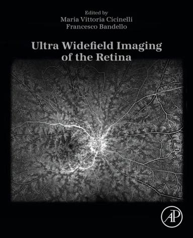 Ultra Widefield Imaging of the Retina
