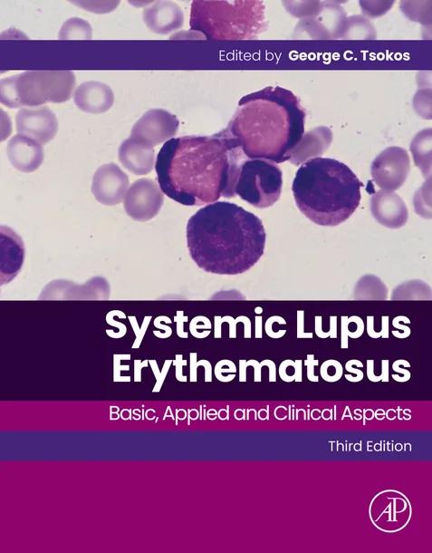 Systemic Lupus Erythematosus cover