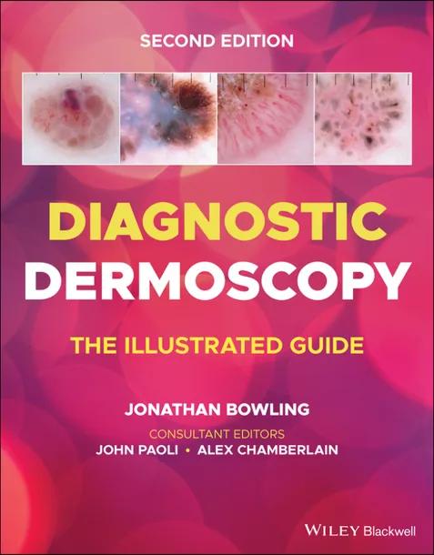 Diagnostic Dermoscopy cover