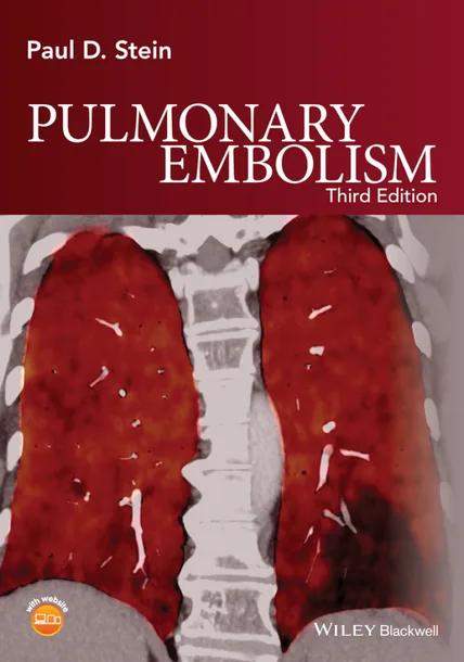 Pulmonary Embolism cover