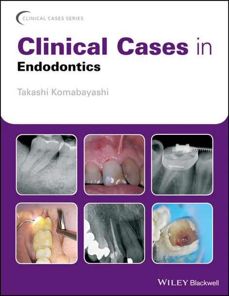 Clinical Cases in Endodontics cover
