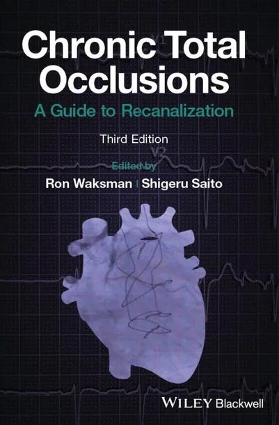 Chronic Total Occlusions cover