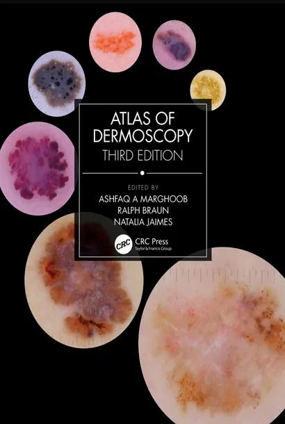 Atlas of Dermoscopy cover