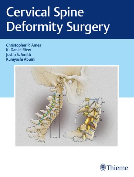 Cervical Spine Deformity Surgery cover