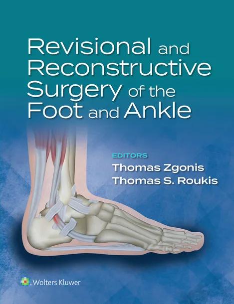 Revisional and Reconstructive Surgery of the Foot and Ankle cover
